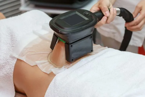 Image of person having fat freezing treatment to help weight gain Llanelli