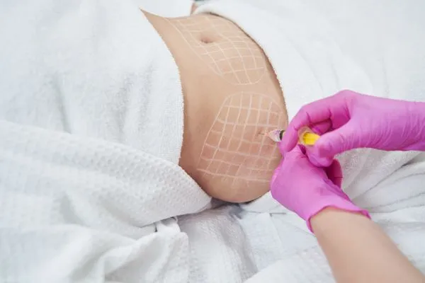 image of fat dissolving injections on love handles to help combat weight gain Llanelli