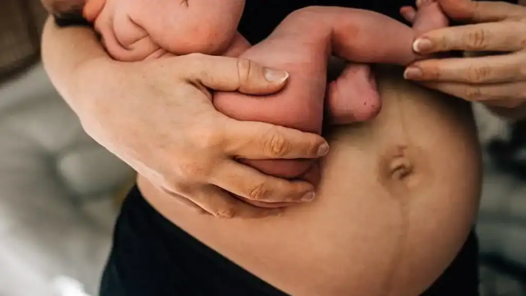 Why Is My Stomach Still Big After Pregnancy Llanelli?